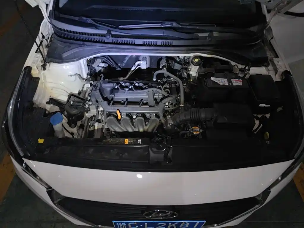 Hyundai Verna — миниатюра 16