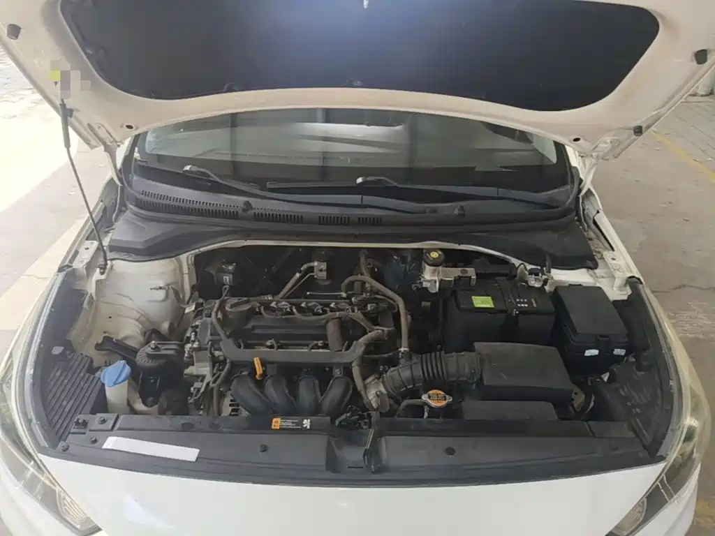 Hyundai Verna RV — миниатюра 20