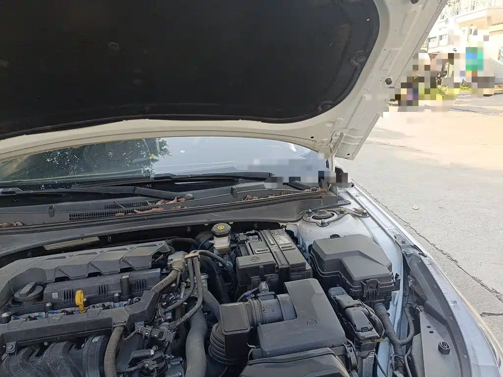 Hyundai Elantra — миниатюра 21