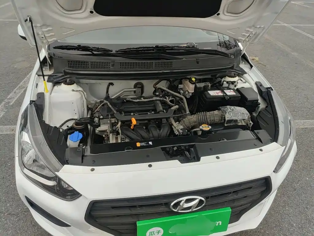 Hyundai Verna — миниатюра 20
