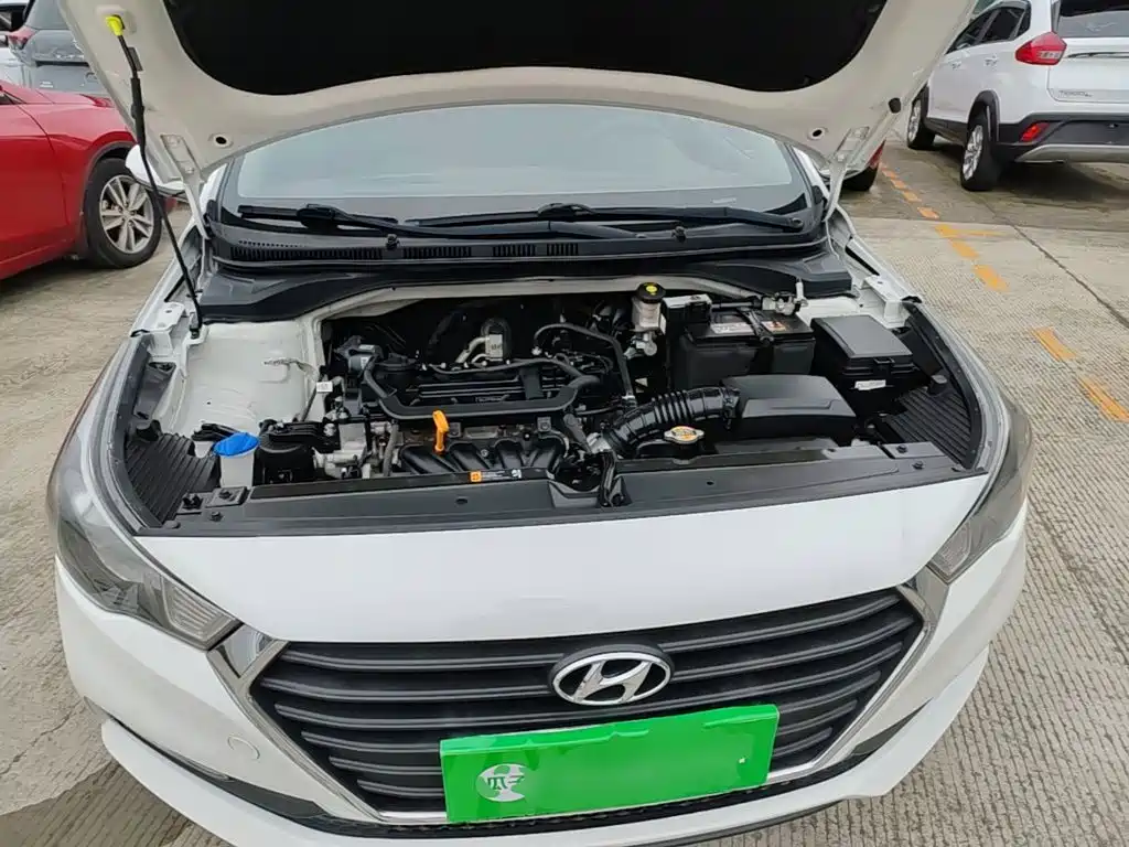 Hyundai Verna — миниатюра 20