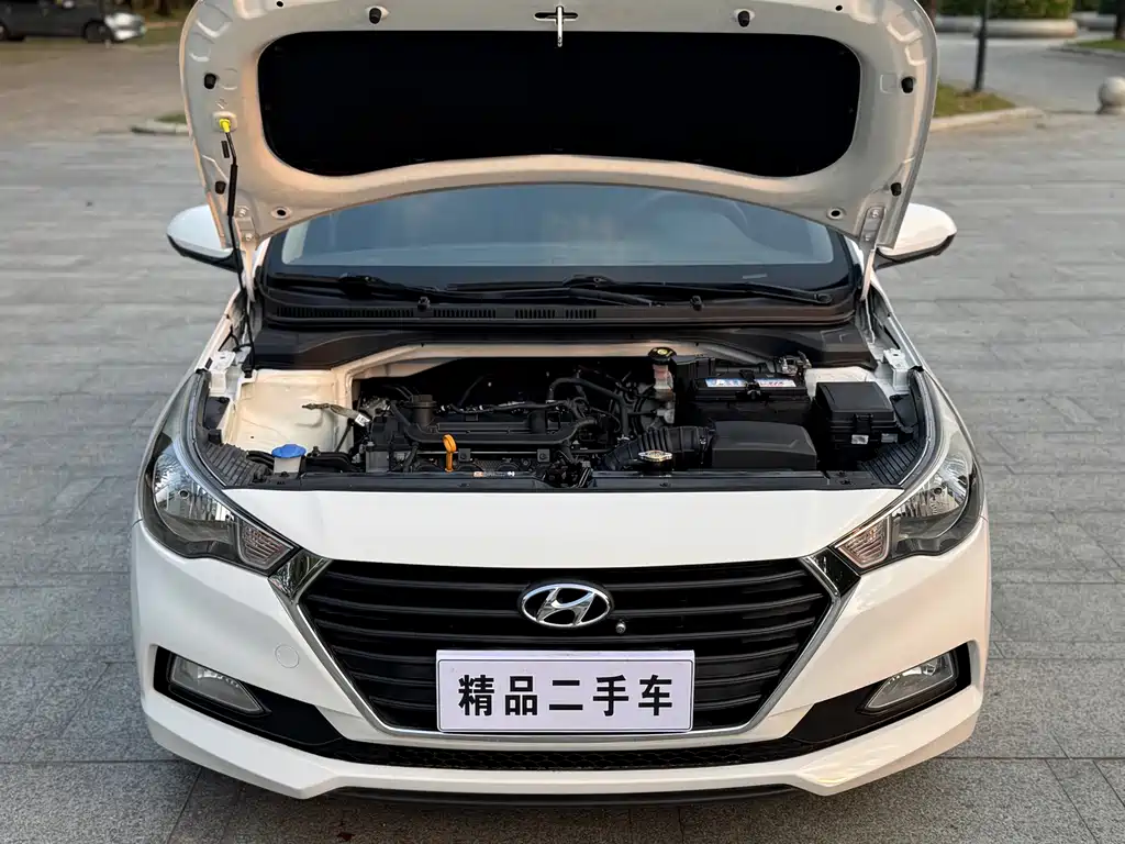 Hyundai Verna — миниатюра 18