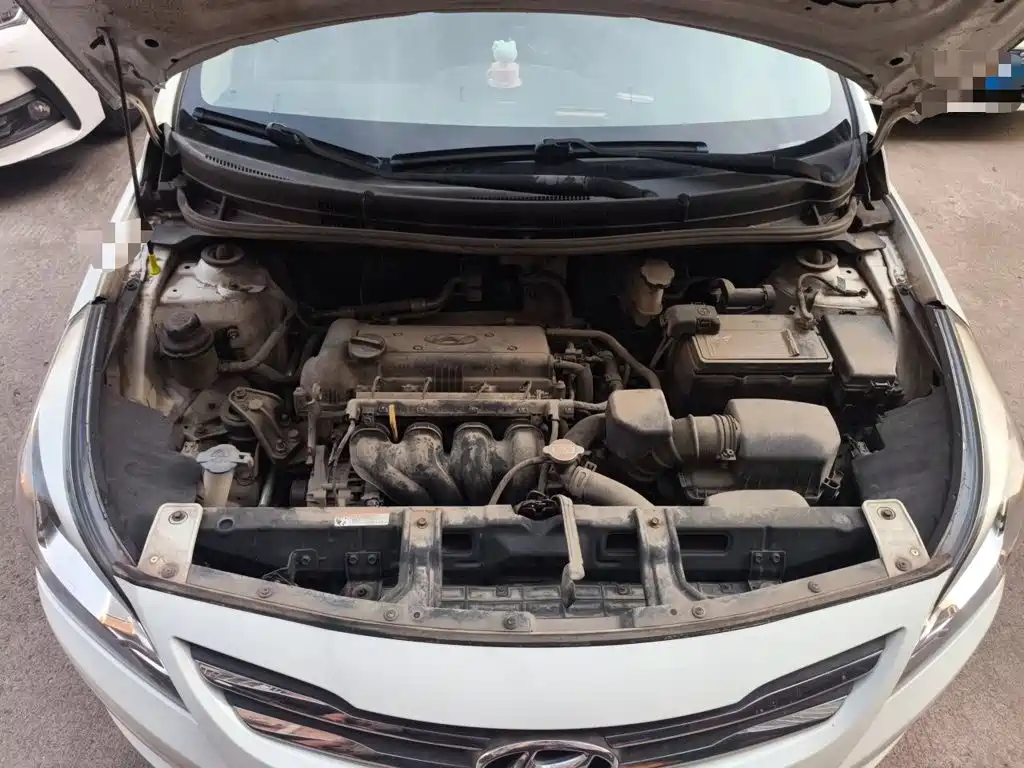 Hyundai Verna — миниатюра 21