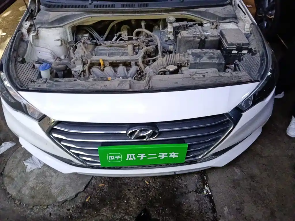 Hyundai Verna — миниатюра 16