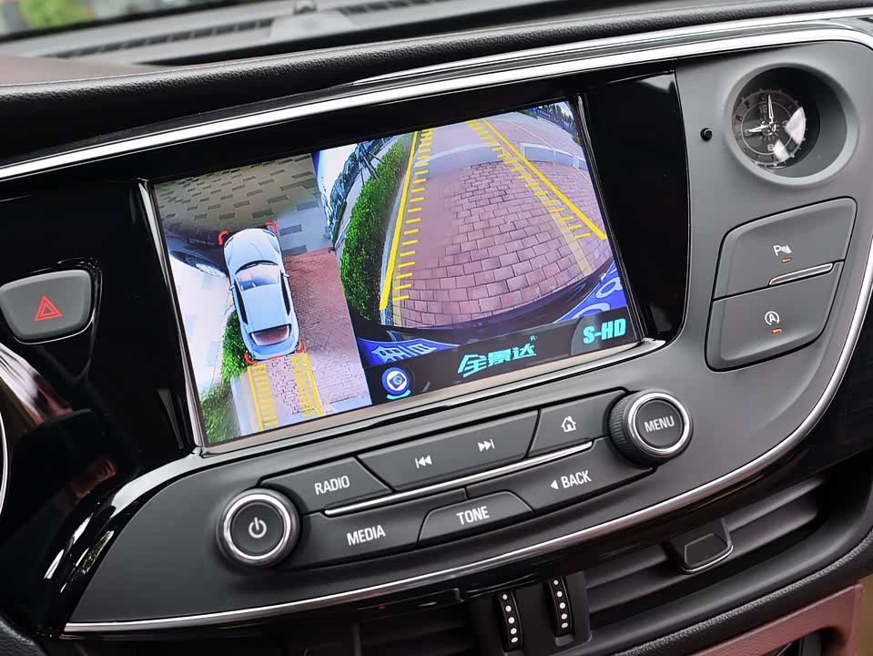 Buick Angkewei Plus