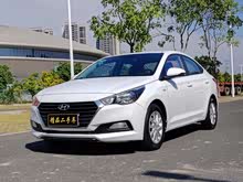 ���� 2016�� 1.4L �Զ��ſ��GLS